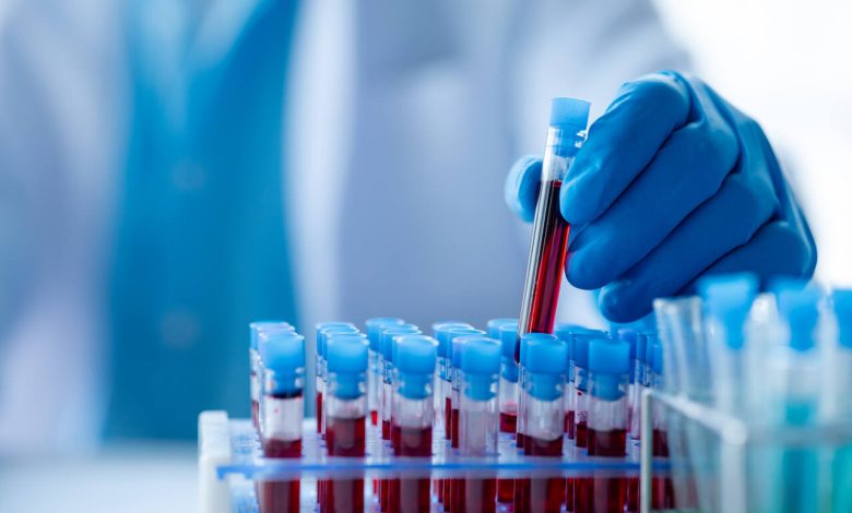 Exames laboratoriais Goiânia
