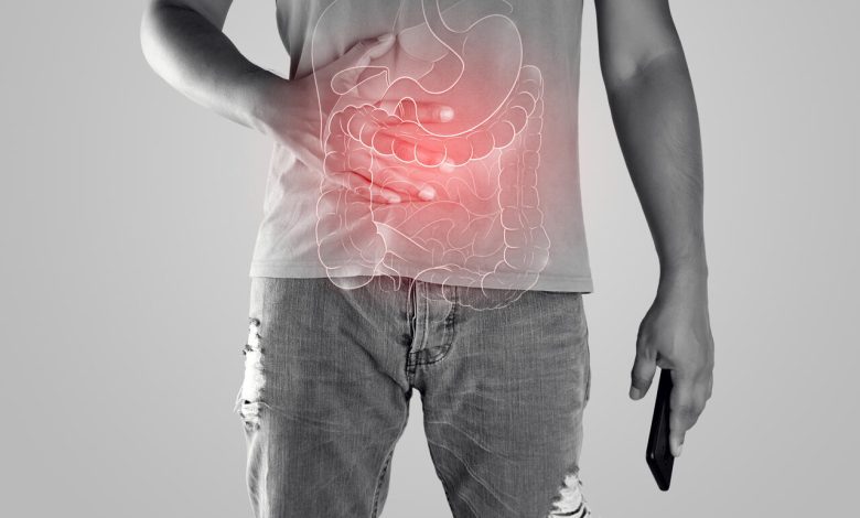 Síndrome do intestino irritável Goiânia